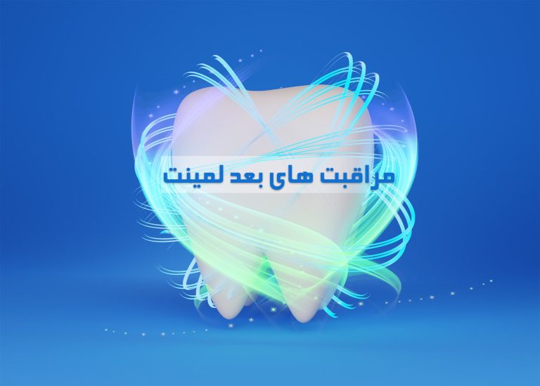 مراقبت های بعد لمینت