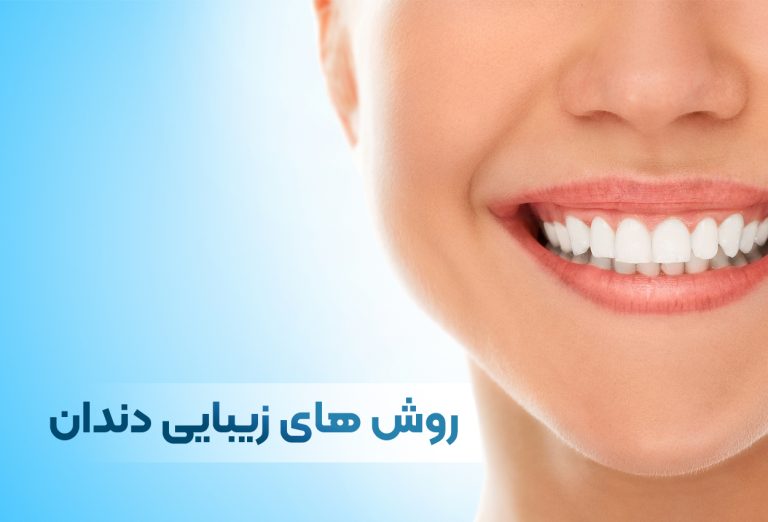 زیبایی دندان