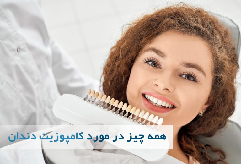 کامپوزیت دندان