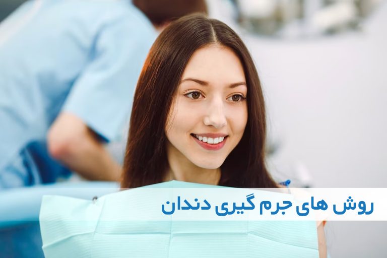جرم گیری