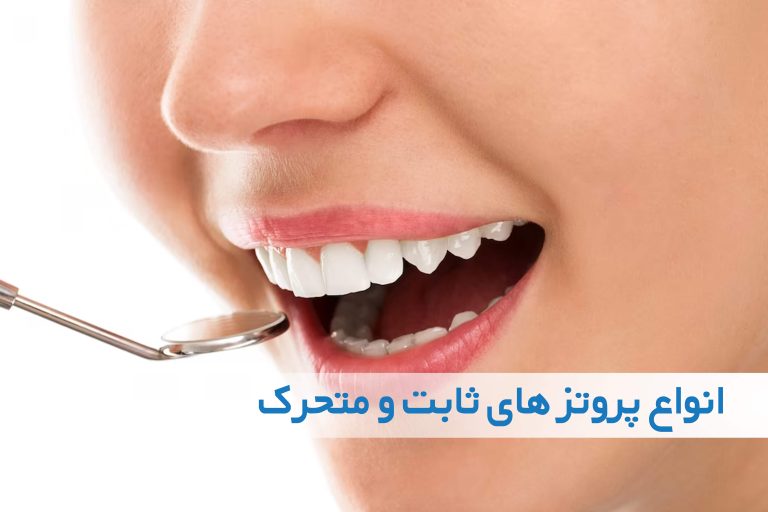 پروتز دندان