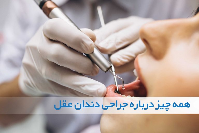 دندان عقل