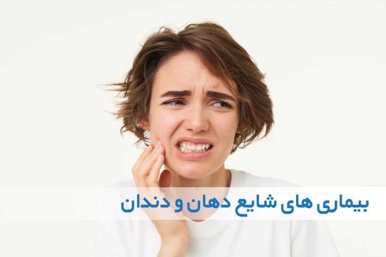 بیماری های شایع دهان و