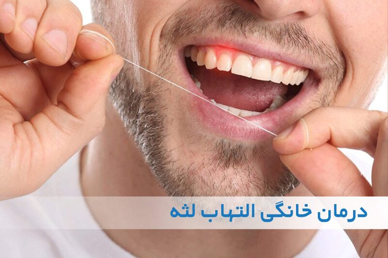 درمان‌های خانگی برای التهاب لثه