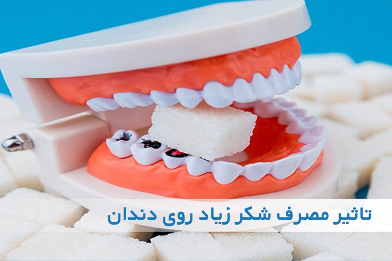 مصرف زیاد شکر