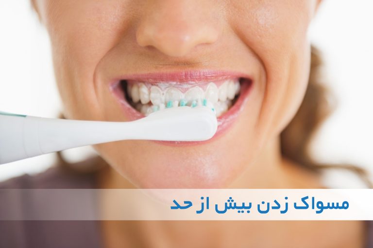 آیا مسواک زدن بیش از حد ضرر دارد؟