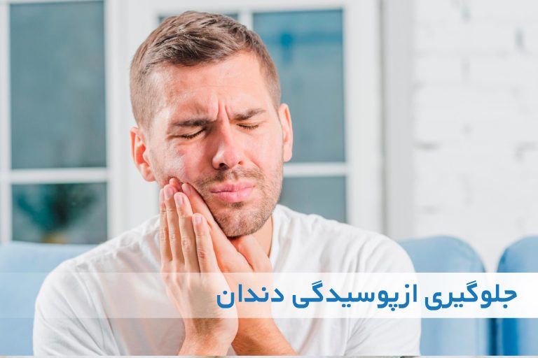 چگونه از پوسیدگی دندان جلوگیری کنیم