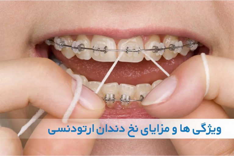 ویژگی‌ها و مزایا نخ دندان ارتودنسی