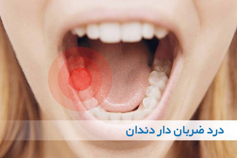 درد ضربان دار دندان