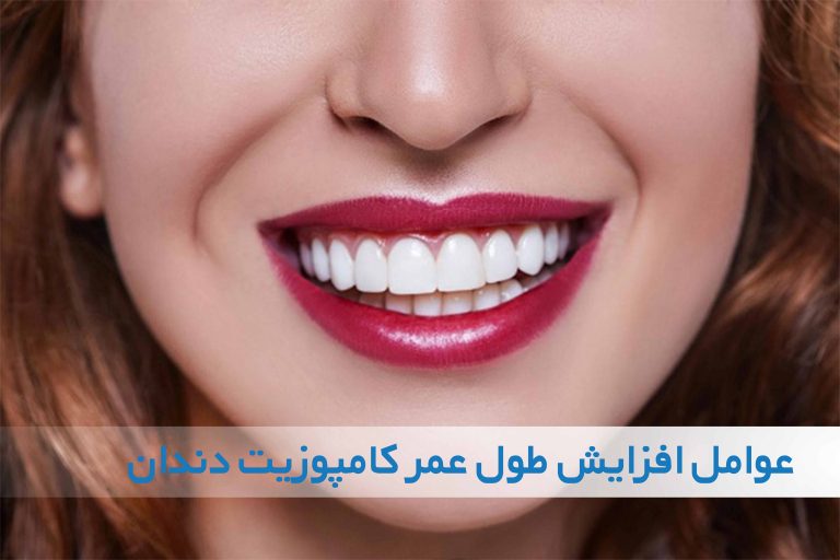 عامل موثر در طول عمر کامپوزیت دندان
