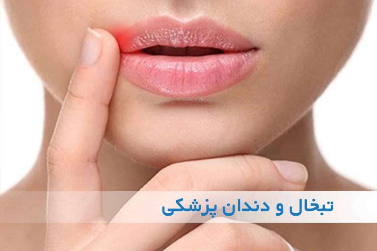 ارتباط تبخال و دندانپزشکی