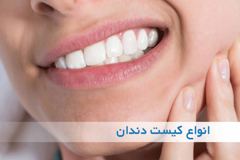 انواع کیست دندان خطرناک