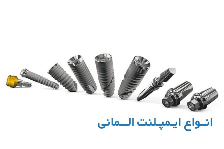 ویژگی انواع ایمپلنت آلمانی