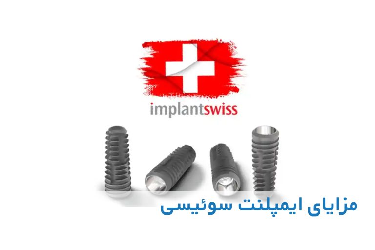 ایمپلنت سوئیسی