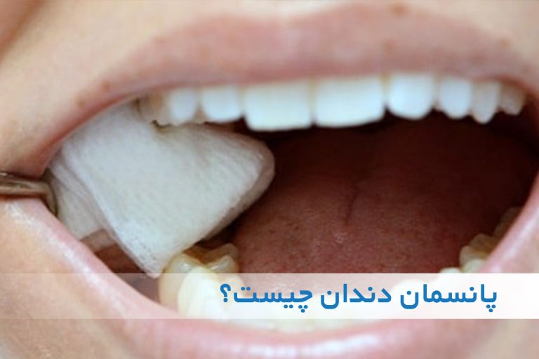 پانسمان دندان