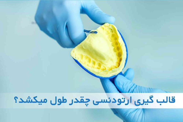 قالب گیری ارتودنسی